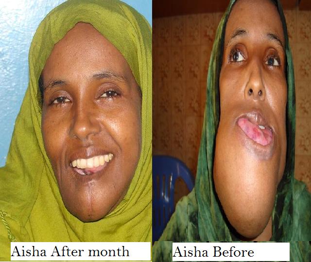 Your generous donations made a cure possible for Aisha